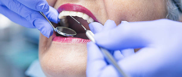 Best Emergency Dental Care for Broken or Chipped Teeth in Boley, OK